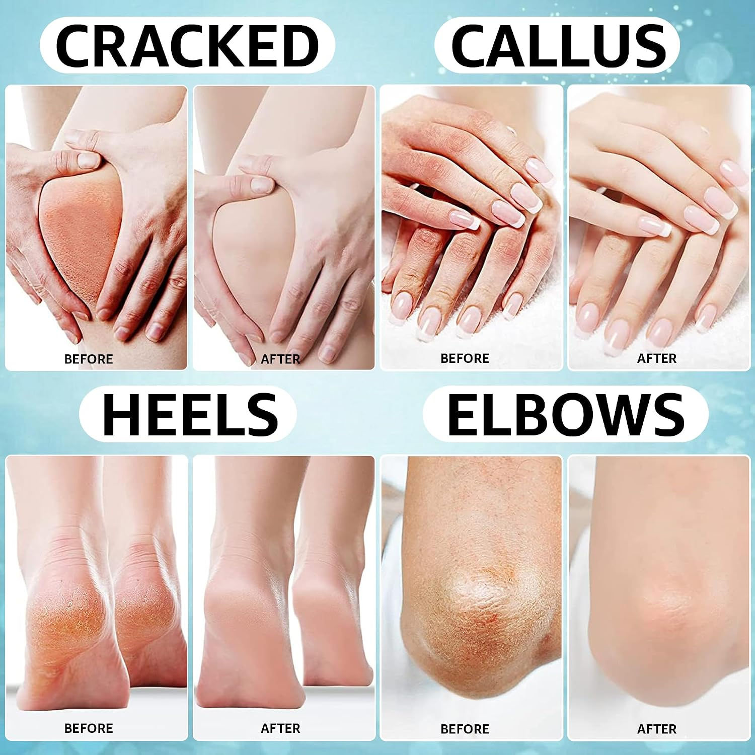 42% Urea Foot Repair Cream with 2% Salicylic Acid - Image 6
