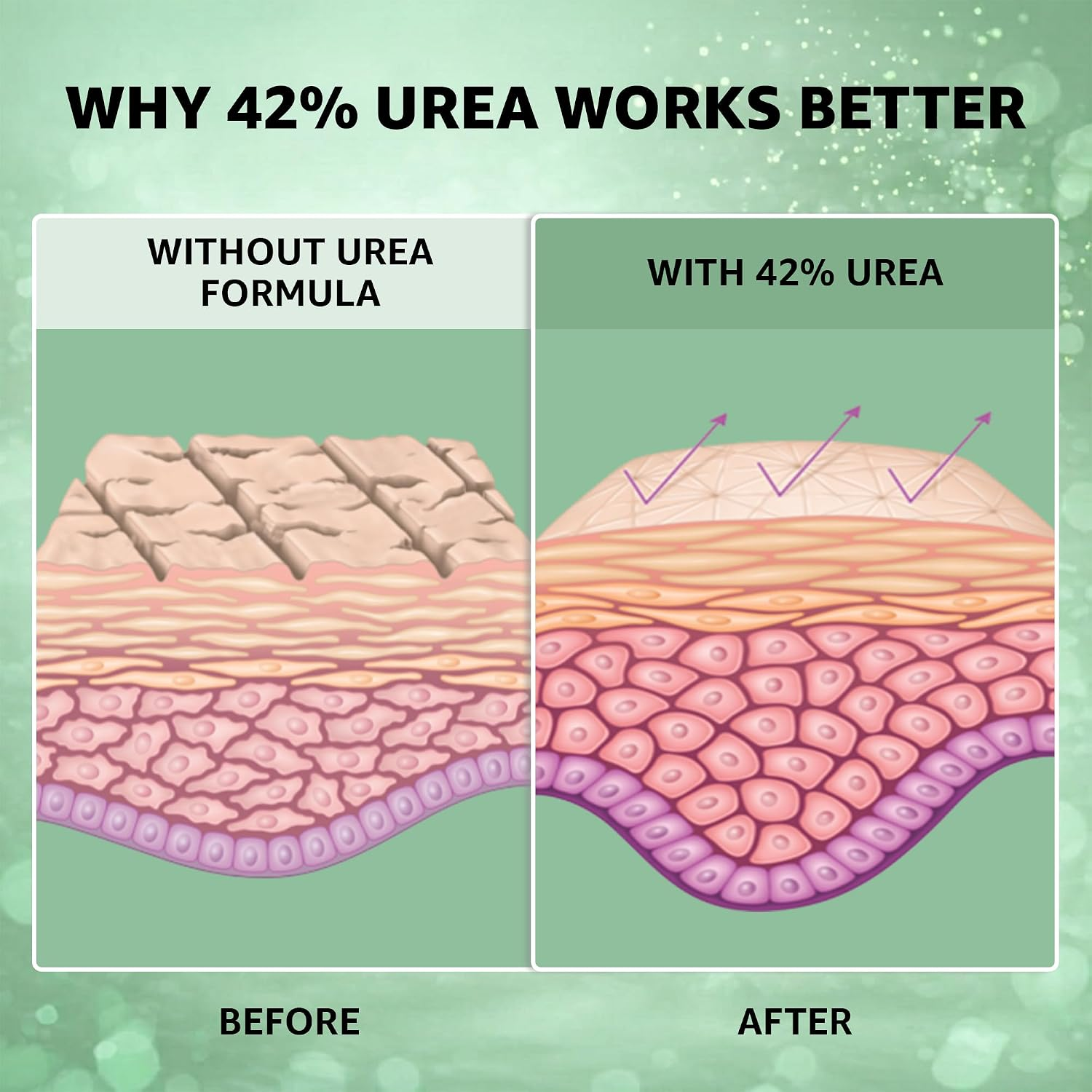 42% Urea Foot Repair Cream for Dry & Cracked Heels - Image 4