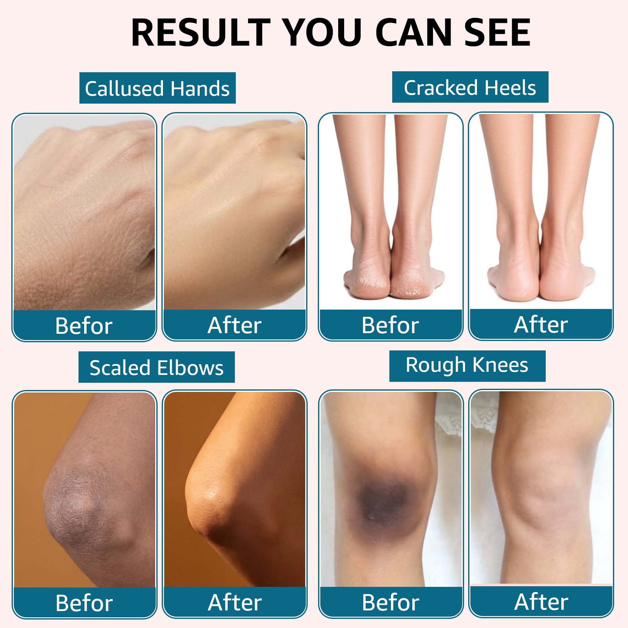 Moisturizing Urea Cream Bundle for Foot Repair | 42% Plus & Max - Image 4